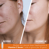 Vitamina C Serum - rhoseskin